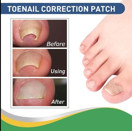 Hanel - Pain Relief Patch