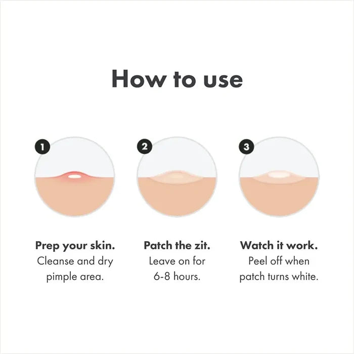 Hydrocolloid Acne Patches for Day & Night